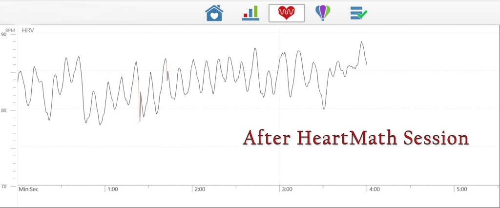 Showing the shift of heart coherence after practicing HeartMath.